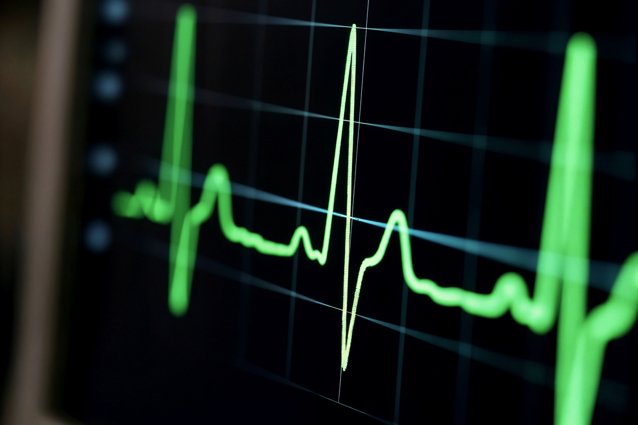 ecg-monitor-displaying-heartbeat_1_1.jpg